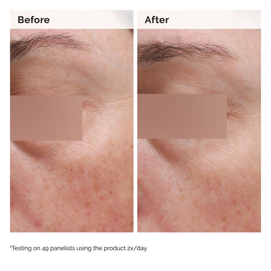 niacinamide-5-face-and-body-emulsion-h9 2024-08-23-ORD-Nia-5pct-Face-Body-B-A-Elasticity-Global-02-1x1.jpg