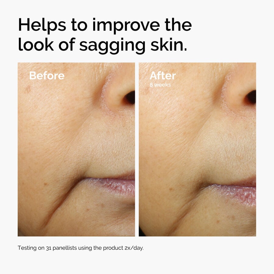 caffeine-3-escin-1-face-serum-z7 ord-caffeine-3pct-escin-1pct-face-serum-before-after-sagging.jpg