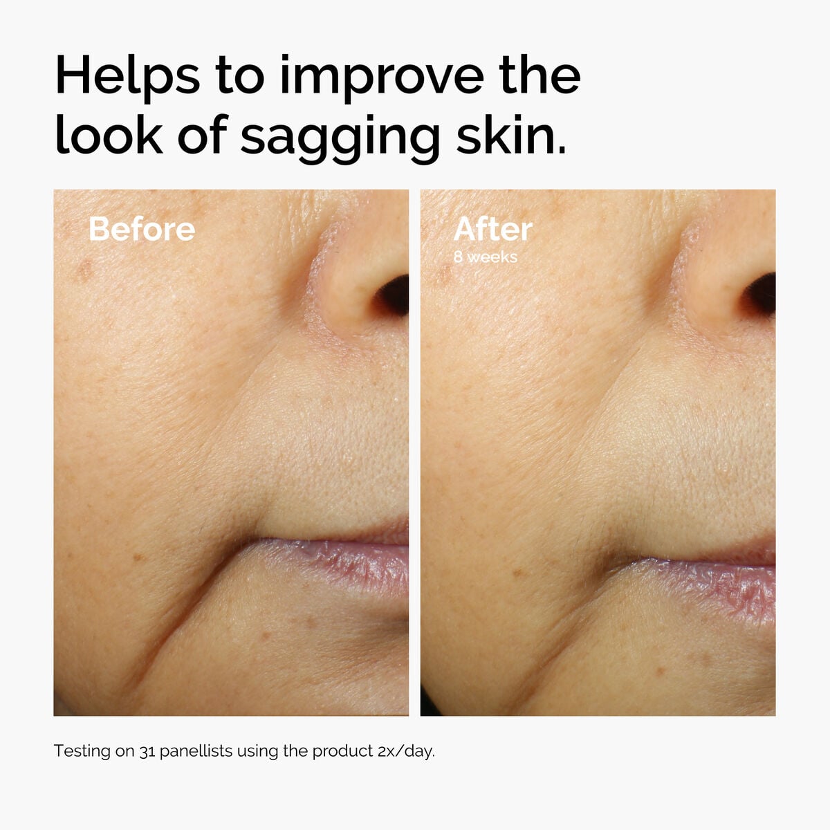 caffeine-3-escin-1-face-serum-z7 ord-caffeine-3pct-escin-1pct-face-serum-before-after-sagging.jpg