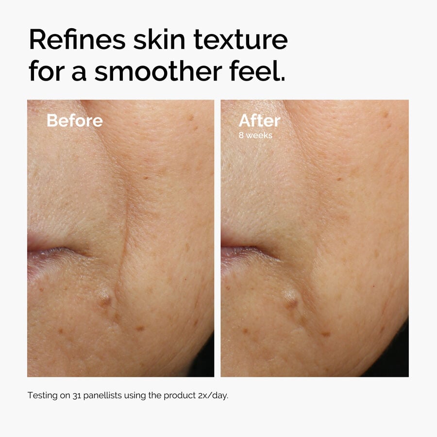 caffeine-3-escin-1-face-serum-z7 ord-caffeine-3pct-escin-1pct-face-serum-before-after-texture.jpg