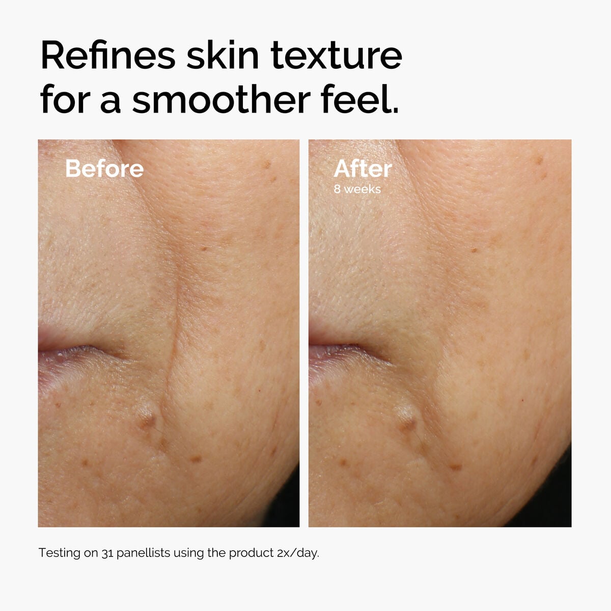 caffeine-3-escin-1-face-serum-z7 ord-caffeine-3pct-escin-1pct-face-serum-before-after-texture.jpg