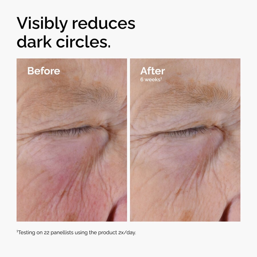 caffeine-solution-5-egcg-eye-serum-z1 ord-caffeine-solution-egcg-dark-circles-before-after.jpg