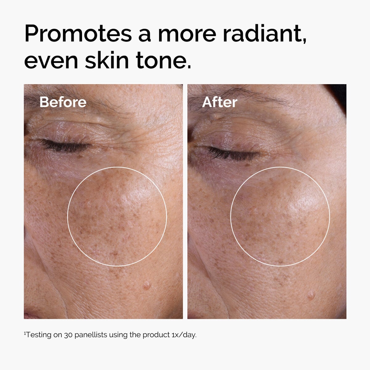 glycolic-acid-7-exfoliating-toner-v4 ord-glycolic-before-after-radiance.jpg
