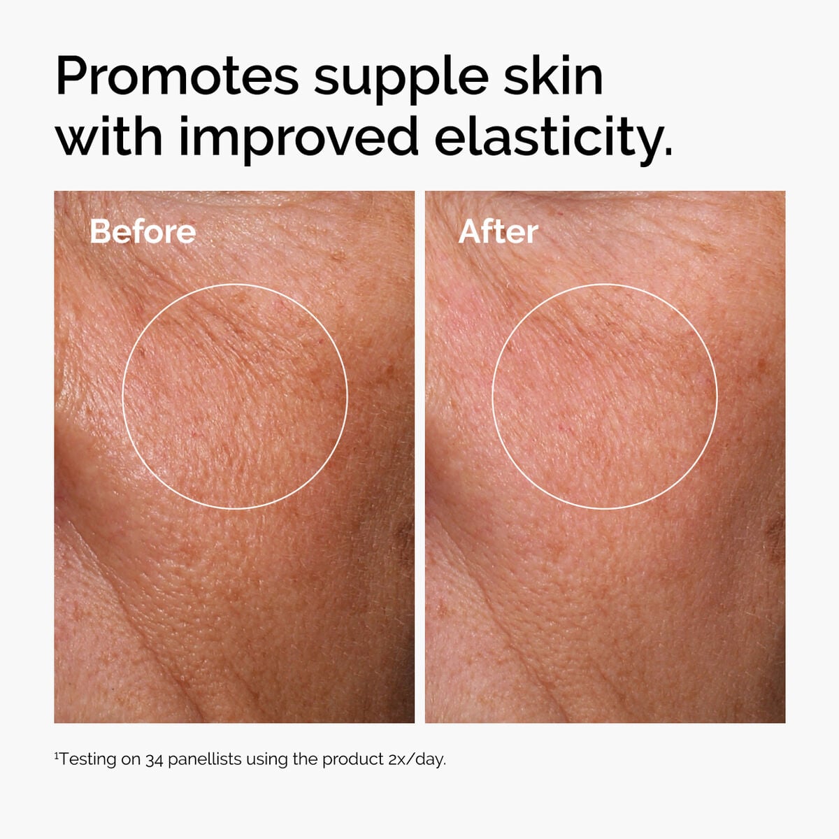 hyaluronic-acid-2-b5-with-ceramides-k8 ord-hyaluronic-acid-2pct-b5-hydrating-serum-before-after-elasticity.jpg