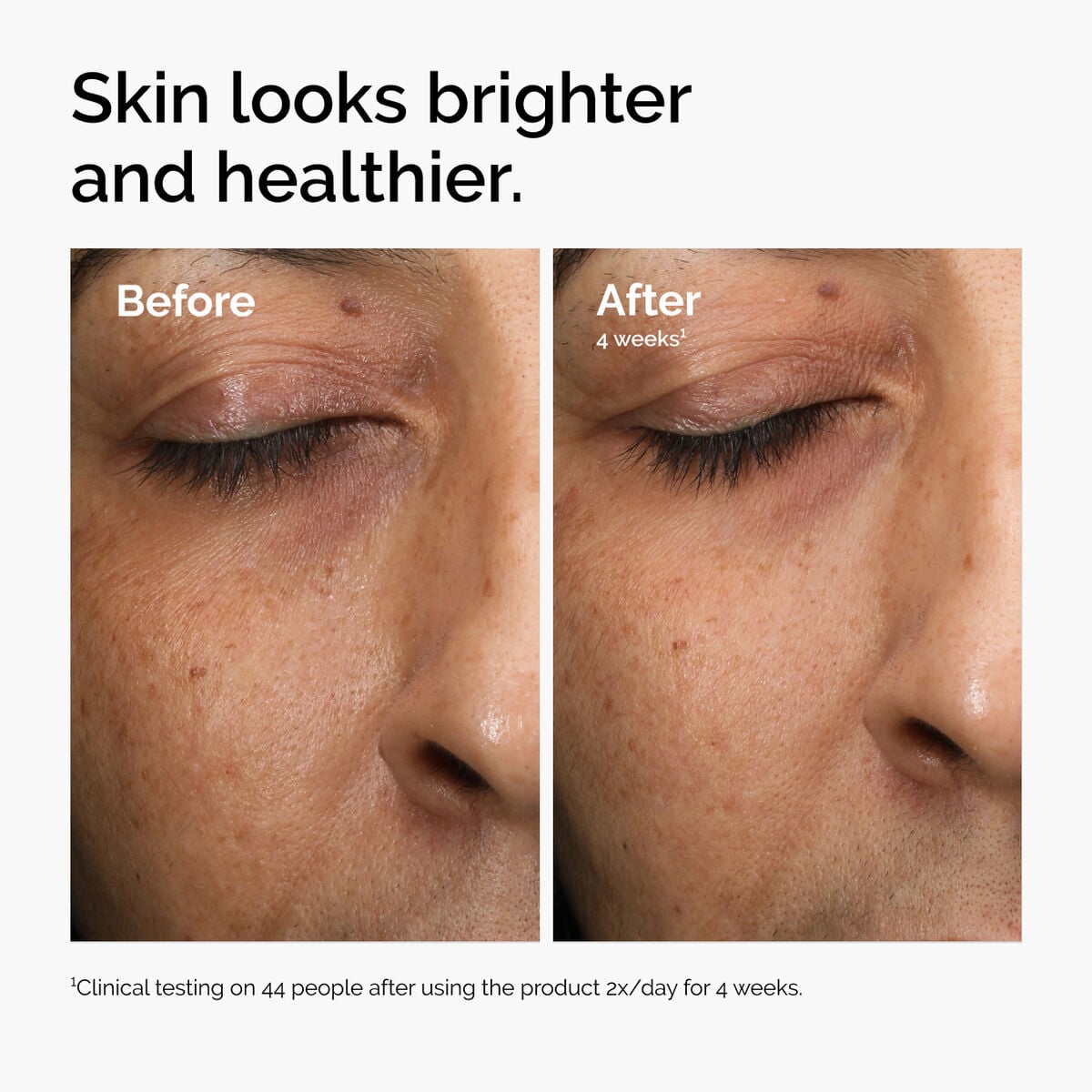 multi-antioxidant-radiance-serum-y1 ord-mars-before-after-healthy.jpg