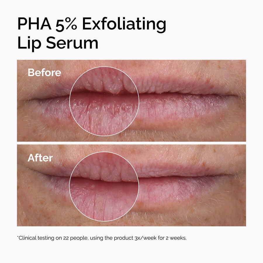 pha-5-exfoliating-lip-serum-v7 ord-pha-5pct-lip-exfoliating-serum-before-after.jpg