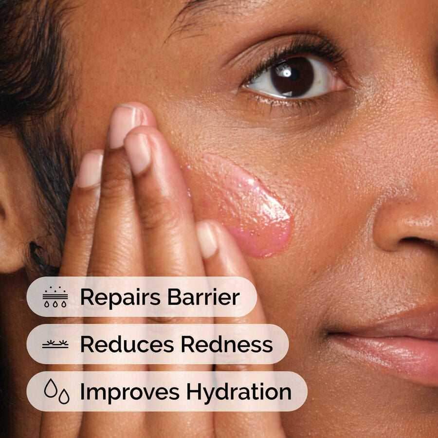 soothing-and-barrier-support-serum-i3 ord-soothing-barrier-support-serum-model-application-with-benefits.jpg